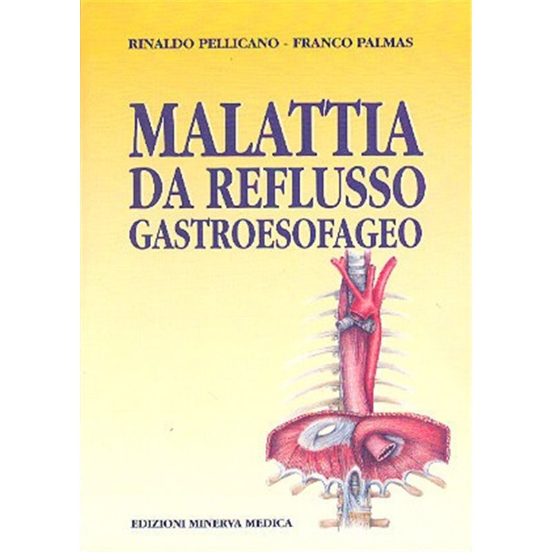 Malattia da reflusso gastroesofageo